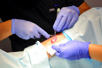 Suncoast Skin Port Charlotte Marketing Ilya Lim, MD-10